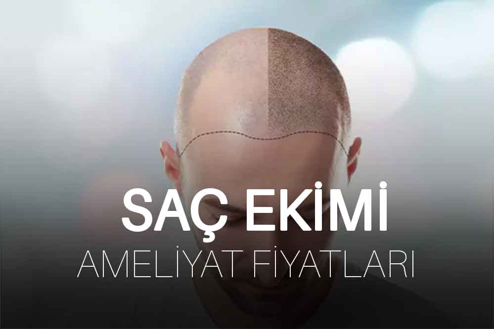 Saç Ekimi Fiyatları