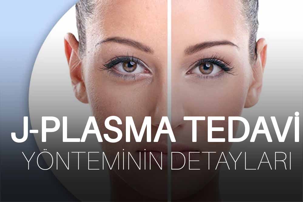 J-Plasma Tedavi Yönteminin Detayları